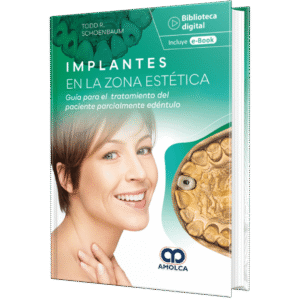 IMPLANTES EN LA ZONA ESTETICA GUIA PARA EL TRATAMIENTO DEL PACIENTE PARCIALMENTE EDENTULO