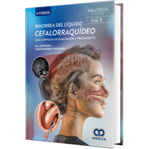 RINORREA DEL LIQUIDO CEFALORRAQUIDEO GUIA COMPLETA DE EVALUACION Y TRATAMIENTO