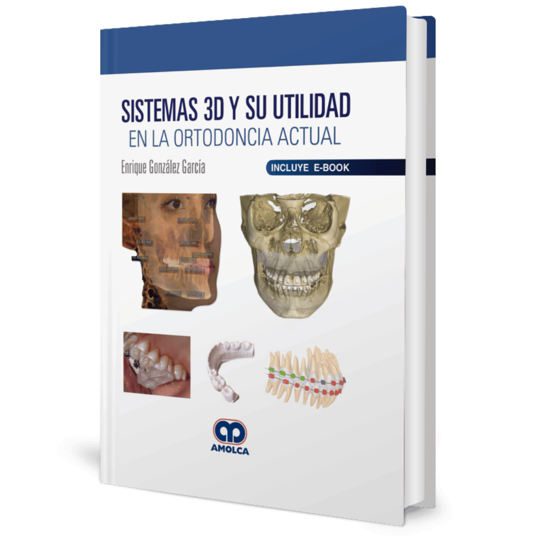 Sistemas 3d y su utilidad en la ortodoncia actual Gonzalez