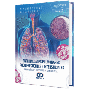 ENFERMEDADES PULMONARES POCO FRECUENTES E INTERSTICIALES CASOS CLINICOS Y DISCUSIONES EN EL MUNDO REAL 1ED