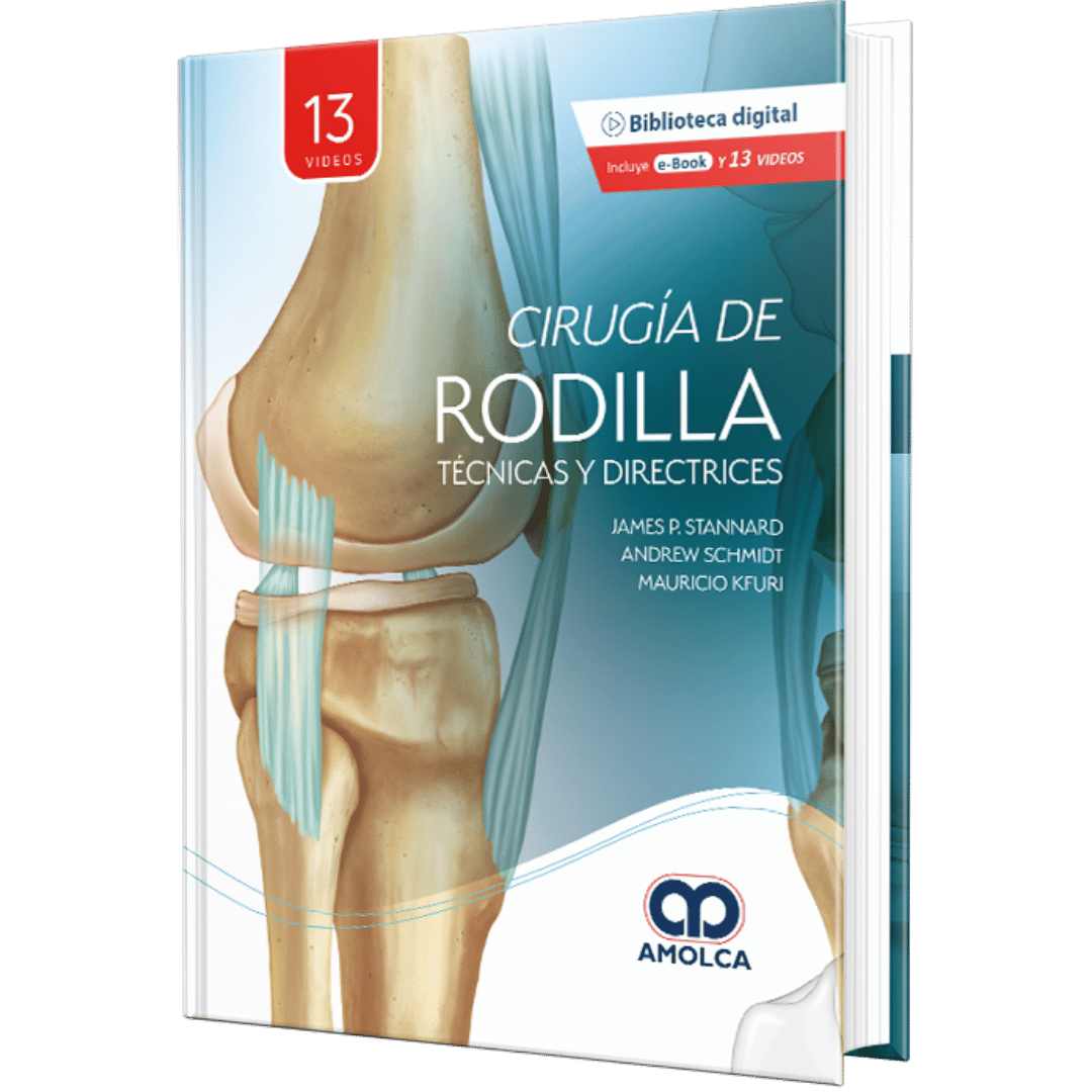 Stannard Cirugia de Rodilla