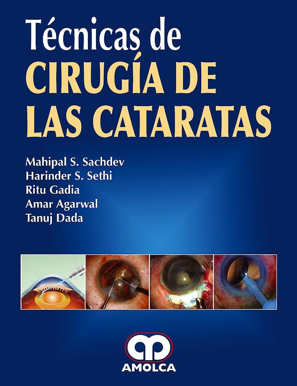 TECNICAS DE CIRUGIA DE LAS CATARATAS - SACHDEV
