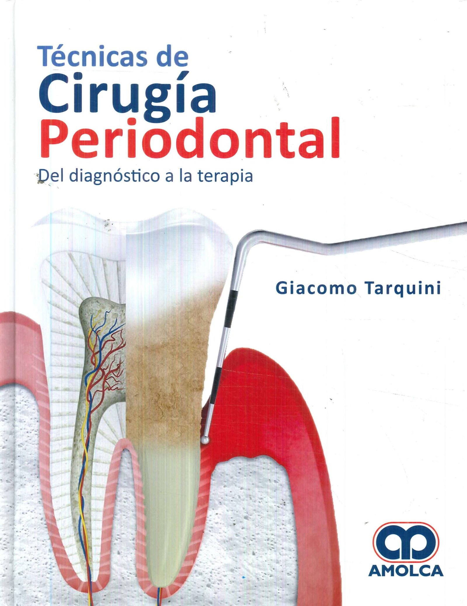 TECNICAS DE CIRUGIA PERIODONTAL DEL DIAGNOSTICO A LA TERAPIA - Imagen 2