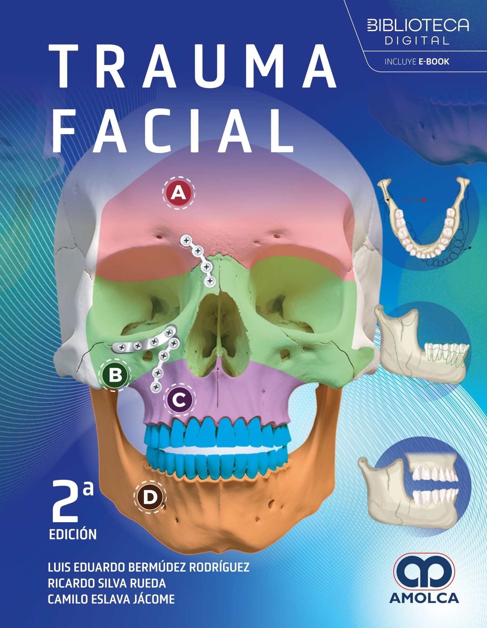 TRAUMA FACIAL 2ED - RODRIGUEZ BERMUDEZ Y SILVA