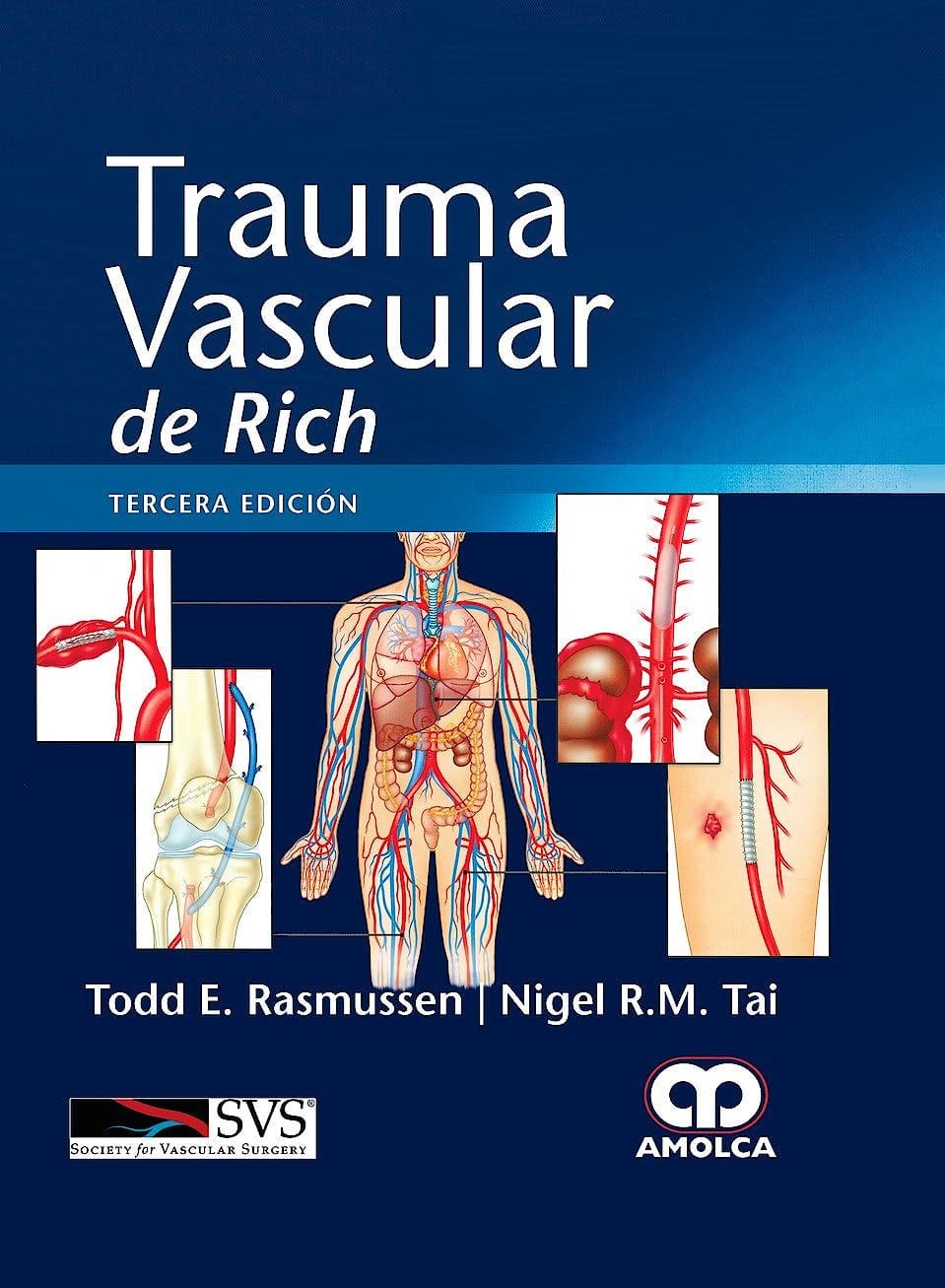 TRAUMA VASCULAR DE RICH 3ED - RASMUSSEN
