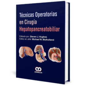 TECNICAS OPERATORIAS EN CIRUGIA HEPATOPANCREATOBILIAS