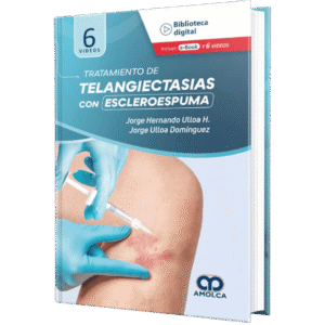TRATAMIENTO DE TELANGIECTASIAS CON ESCLEROESPUMA