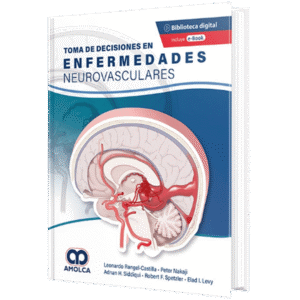 TOMA DE DECISIONES EN ENFERMEDADES NEUROVASCULARES