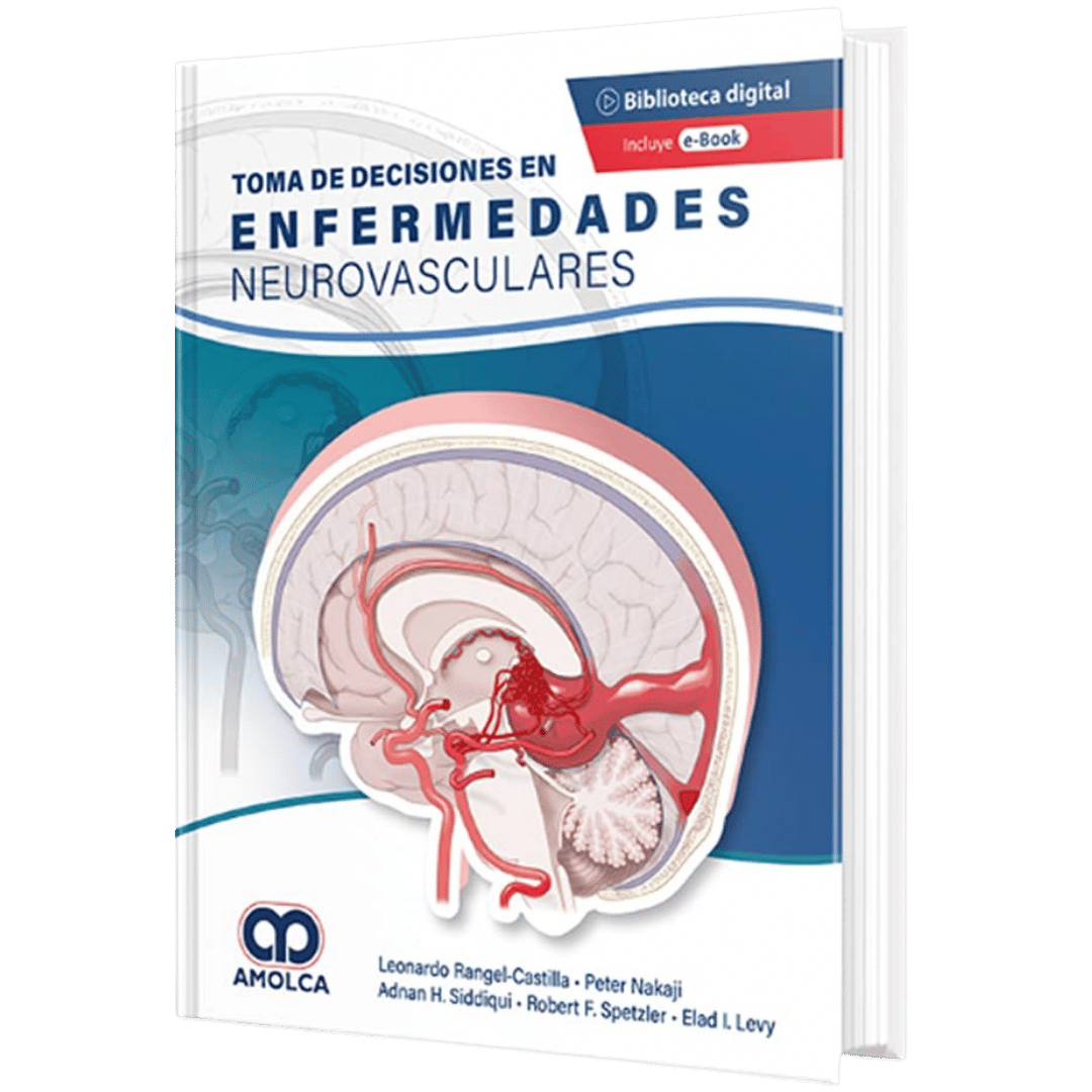 Toma de decisiones en enfermedades neurovasculares Rangel-Castilla
