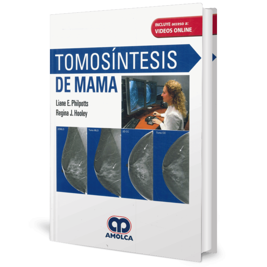 Tomosintesis de Mama Philpotts