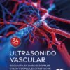 ULTRASONIDO VASCULAR ECOGRAFIA EN MODO B, DOPPLER COLOR Y DUPLEX, ECOGRAFIA CON CONTRASTE MEJORADO - KUBALE