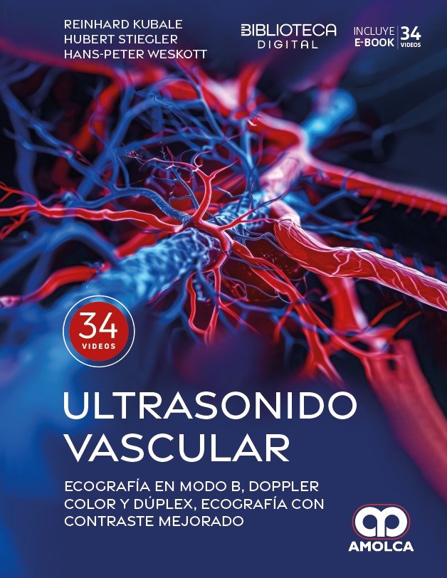 ULTRASONIDO VASCULAR ECOGRAFIA EN MODO B, DOPPLER COLOR Y DUPLEX, ECOGRAFIA CON CONTRASTE MEJORADO - KUBALE