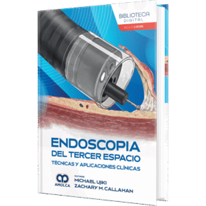 ENDOSCOPIA DEL TERCER ESPACIO TECNICAS Y APLICACIONES CLINICAS