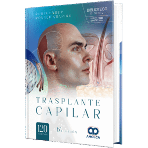 TRASPLANTE CAPILAR 6ED