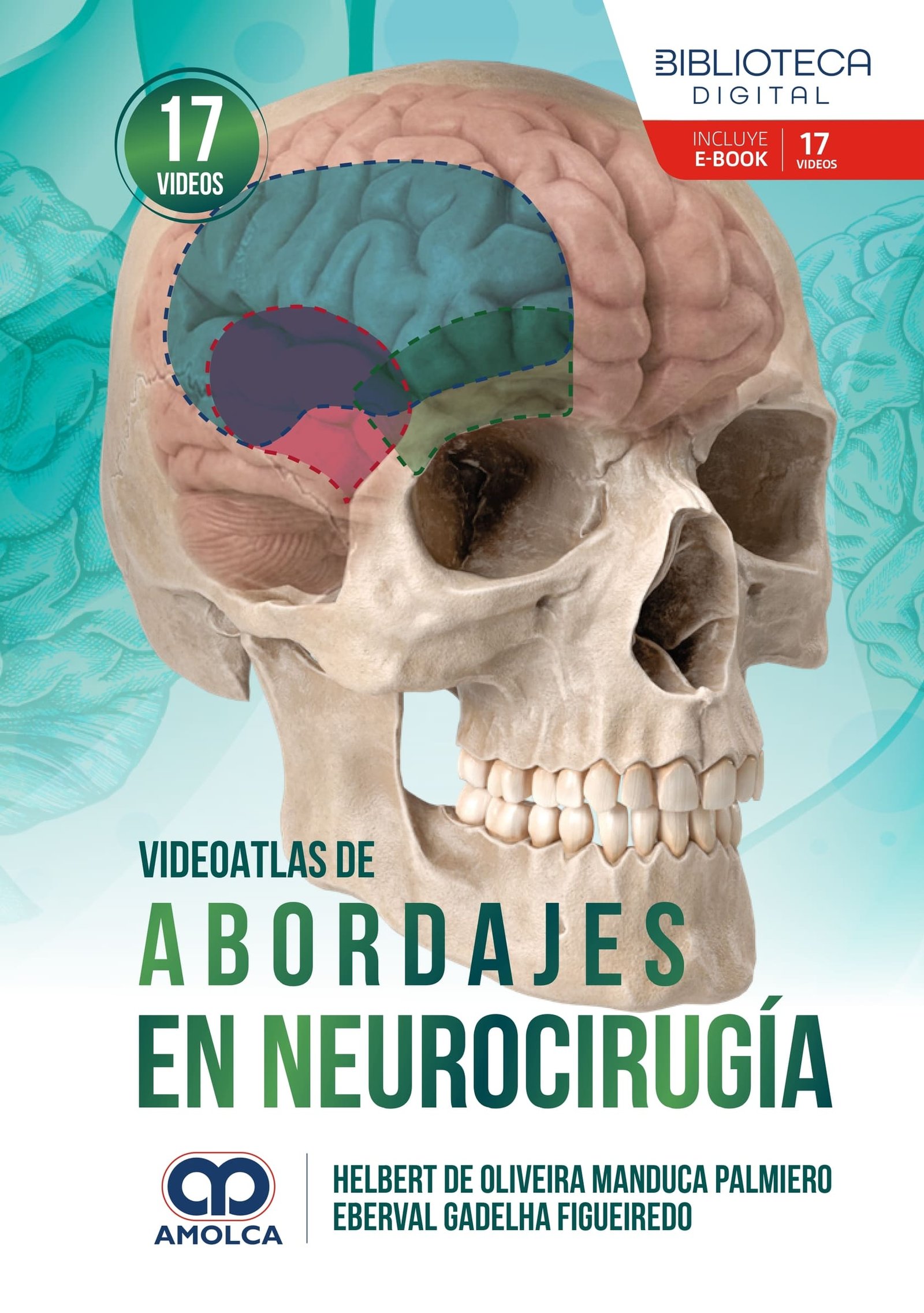 VIDEOATLAS DE ABORDAJES EN NEUROCIRUGIA - Imagen 2