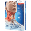 Valcavi Ablación Tiroidea