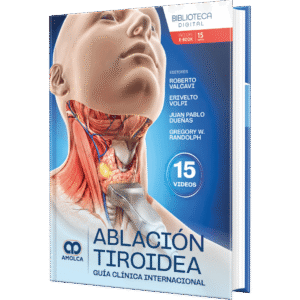 ABLACION TIROIDEA GUIA CLINICA INTERNACIONAL
