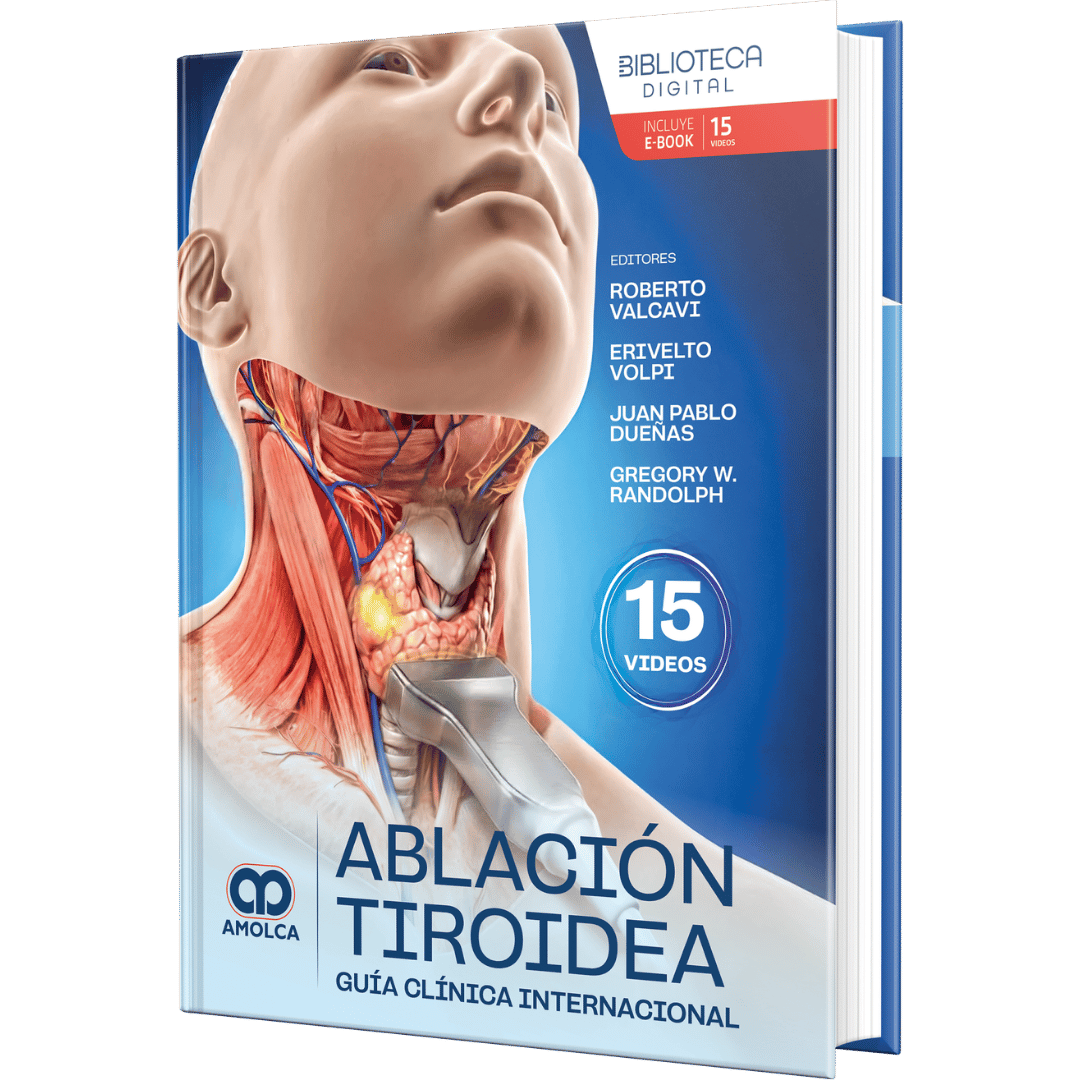 Valcavi Ablación Tiroidea