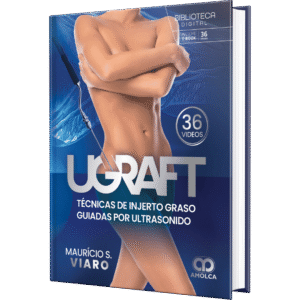 UGRAFT TECNICAS DE INJERTO GRASO GUIADAS POR ULTRASONIDO
