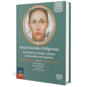 ZONAS FACIALES PELIGROSAS SEGURIDAD EN CIRUGIA, RELLENOS Y DISPOSITIVOS NO INVASIVOS