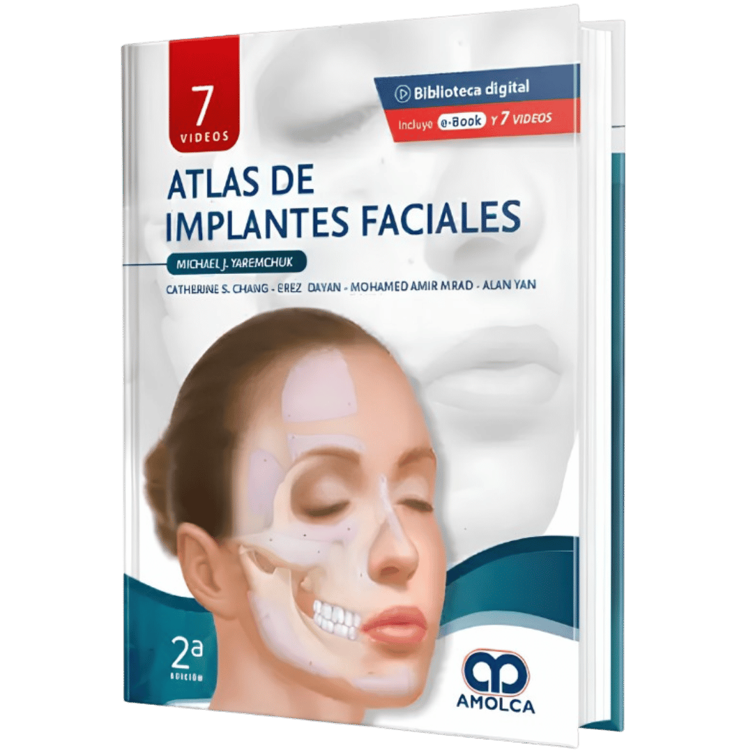 atlas de Implantes Faciales Yaremchuk