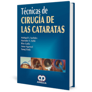 TECNICAS DE CIRUGIA DE LAS CATARATAS