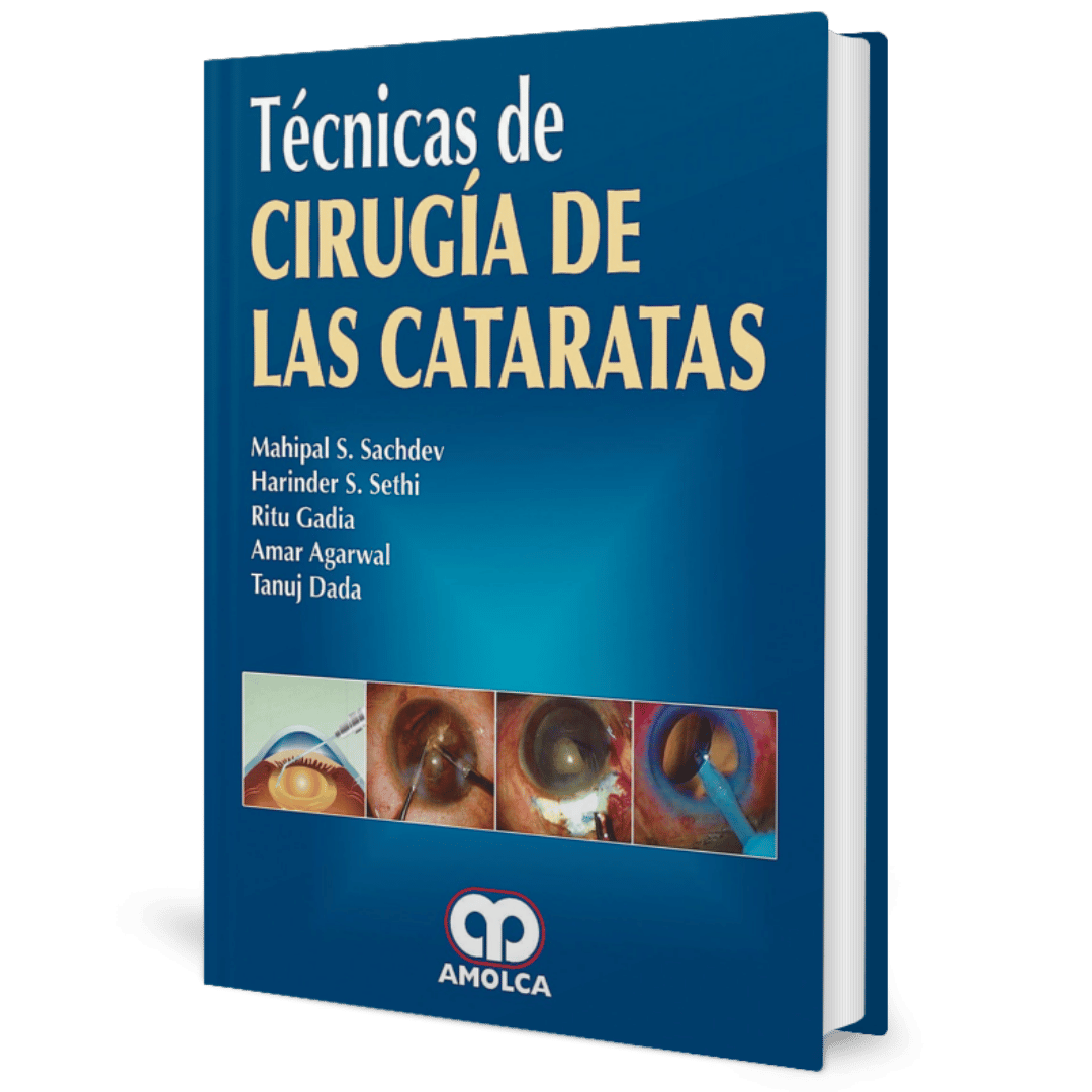 tecnicas de Cirugia de Cataratas Sachdev